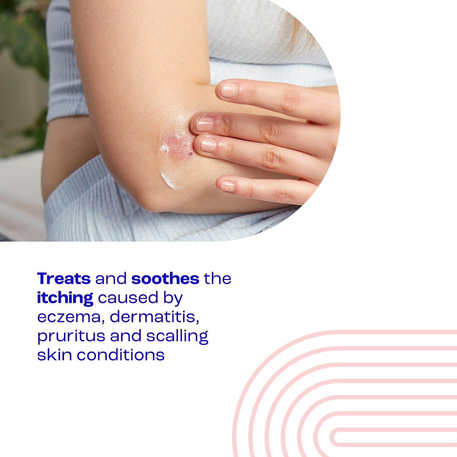 Itch Relief Cream