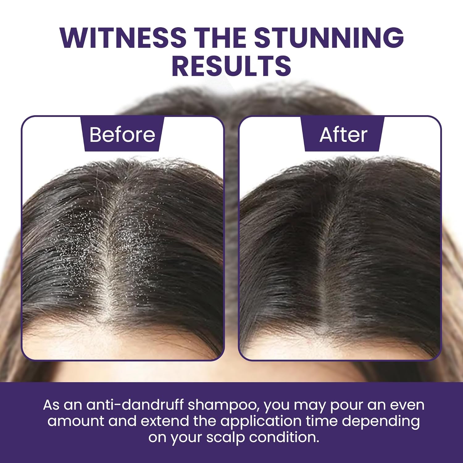 Dry Itchy Scalp Shampoo