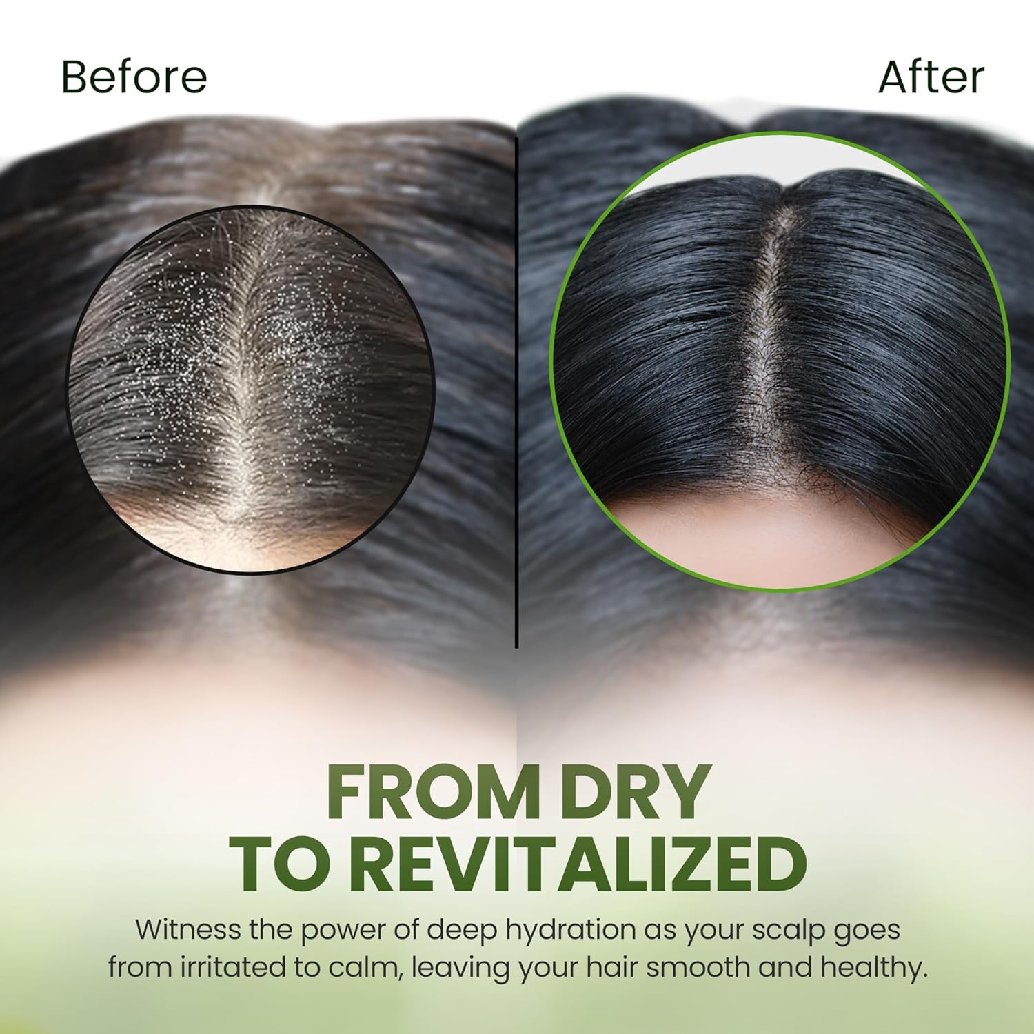 Sunflower Oil Root Revitalizer For Dry, Itchy Scalp
