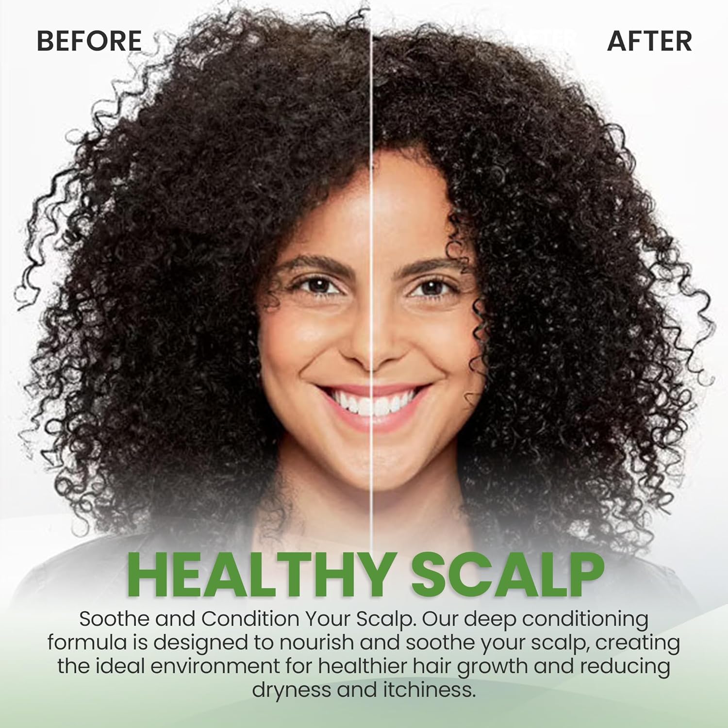 Super Gro Hair& Scalp Conditioner