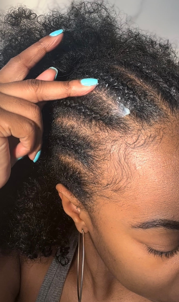 Anti Itch & Tension Relief Scalp Butter With Tea Tree & Aloe