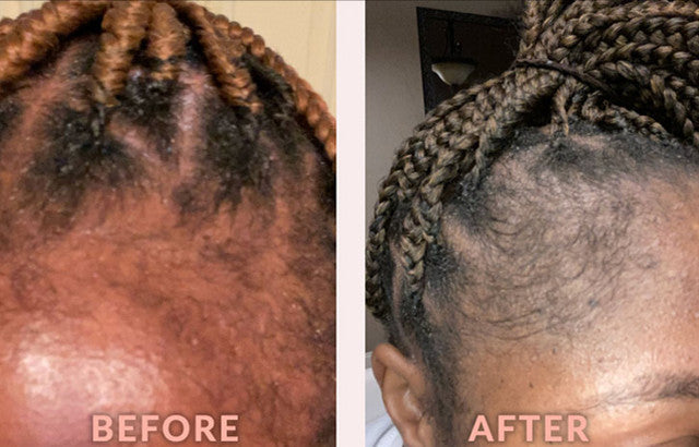 Scalp Care Edge & Temple Strengthening Oil Biotin & Black Castor Oil